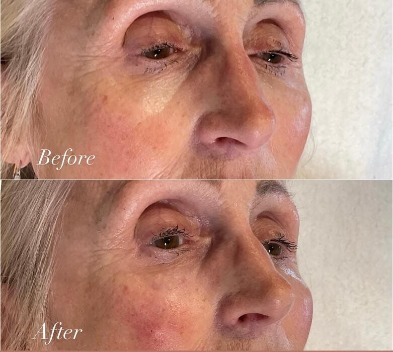 Images Subtle Aesthetics