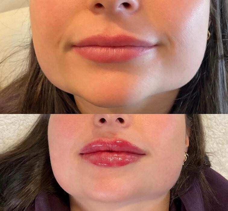 Images Subtle Aesthetics