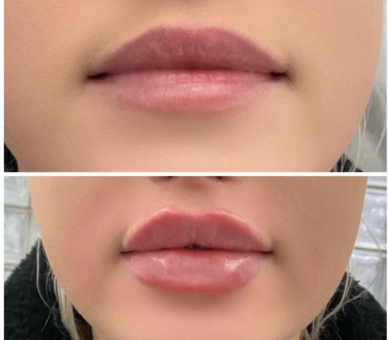 Images Subtle Aesthetics