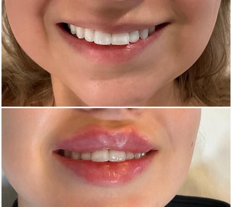 Images Subtle Aesthetics