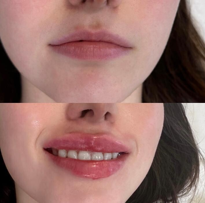 Images Subtle Aesthetics