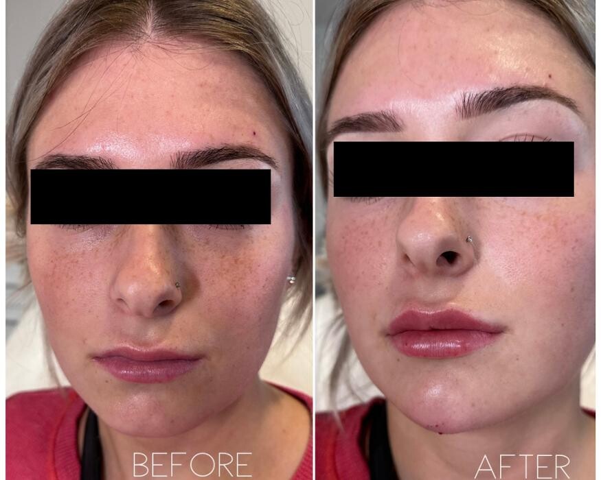 Images Subtle Aesthetics