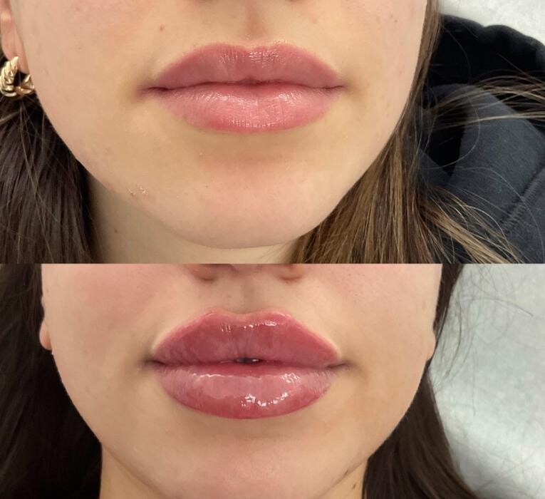 Images Subtle Aesthetics