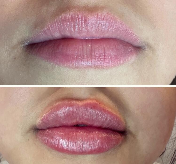 Images Subtle Aesthetics