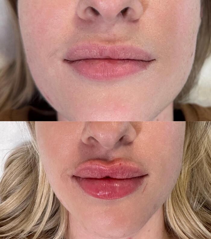 Images Subtle Aesthetics