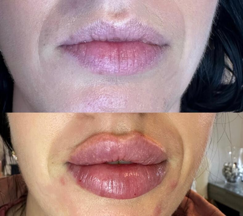 Images Subtle Aesthetics