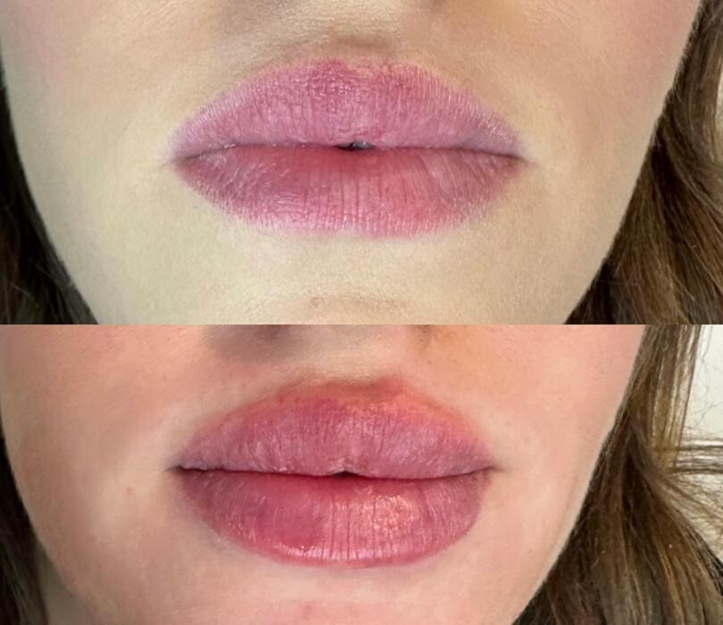 Images Subtle Aesthetics