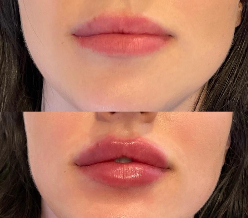 Images Subtle Aesthetics