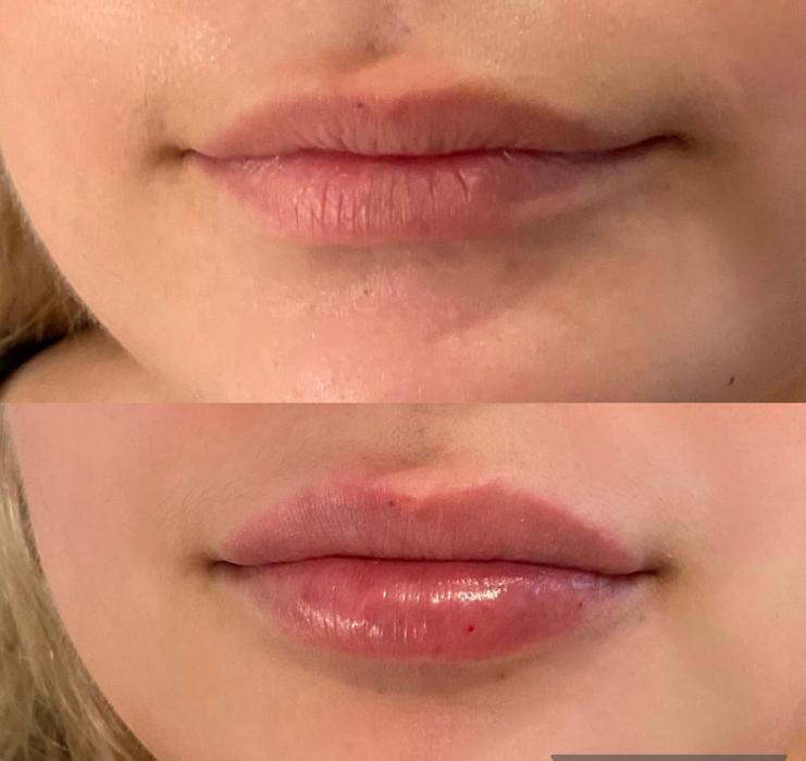 Images Subtle Aesthetics