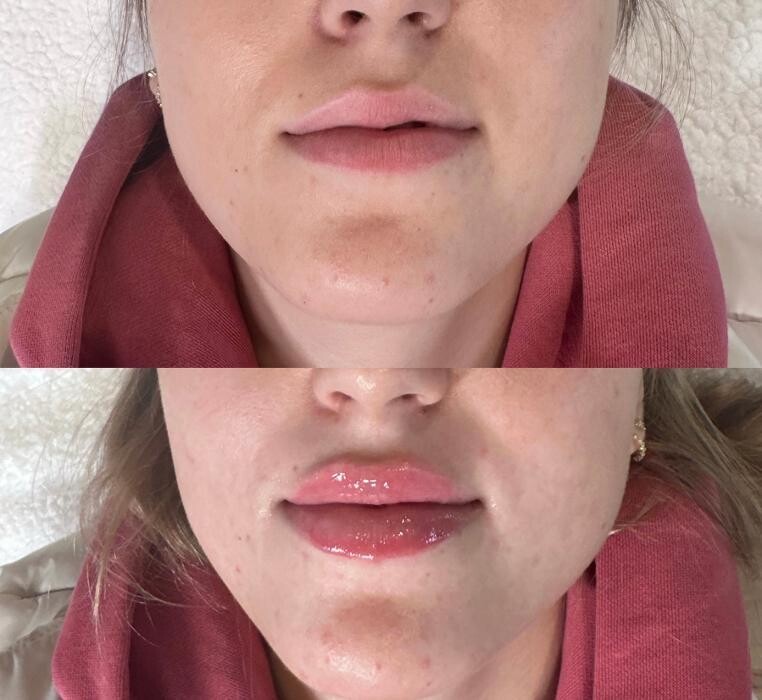 Images Subtle Aesthetics