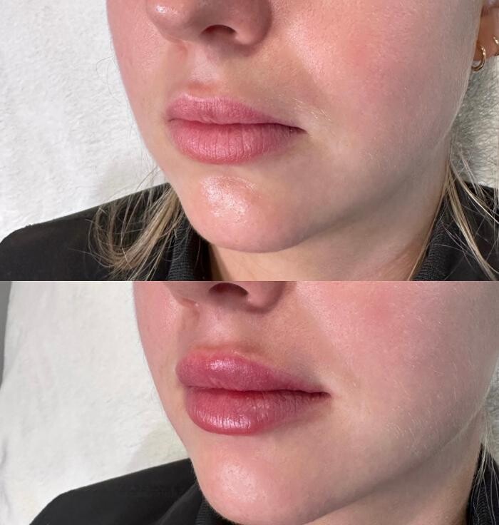 Images Subtle Aesthetics