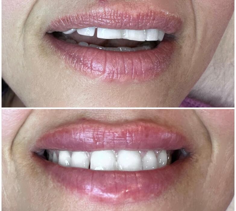 Images Subtle Aesthetics