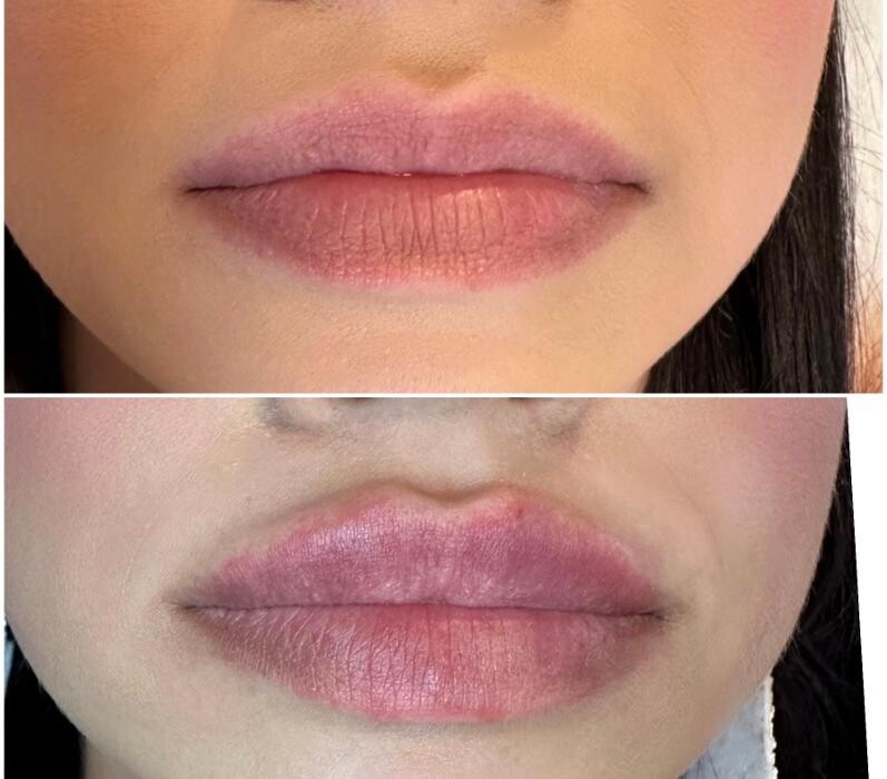 Images Subtle Aesthetics