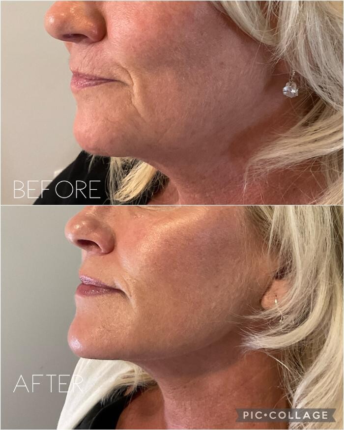 Images Subtle Aesthetics