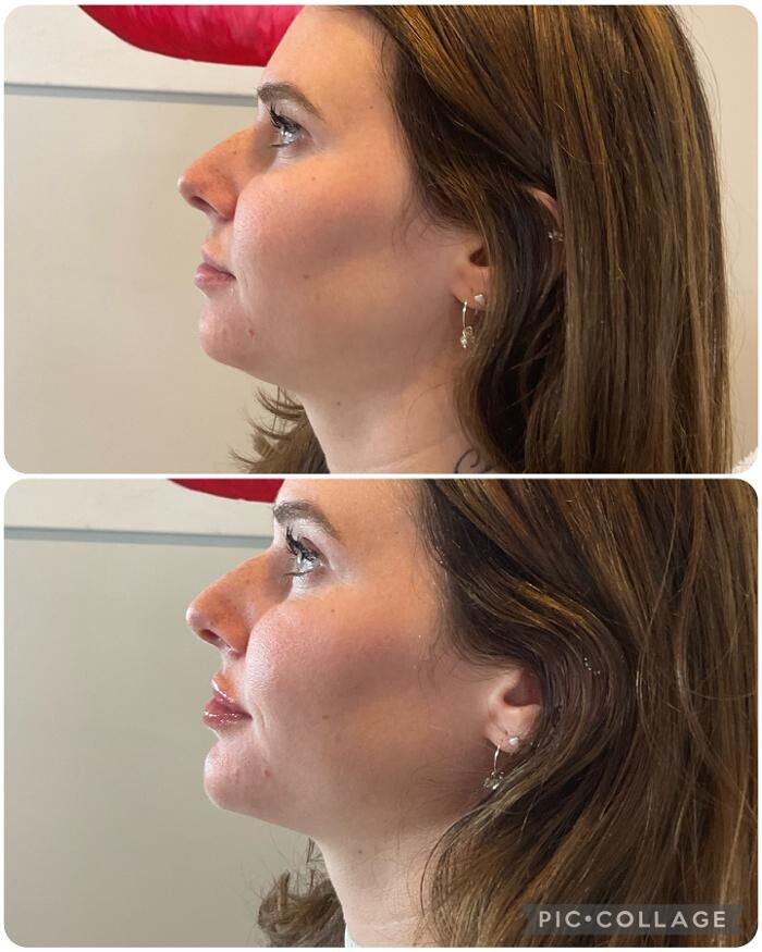 Images Subtle Aesthetics