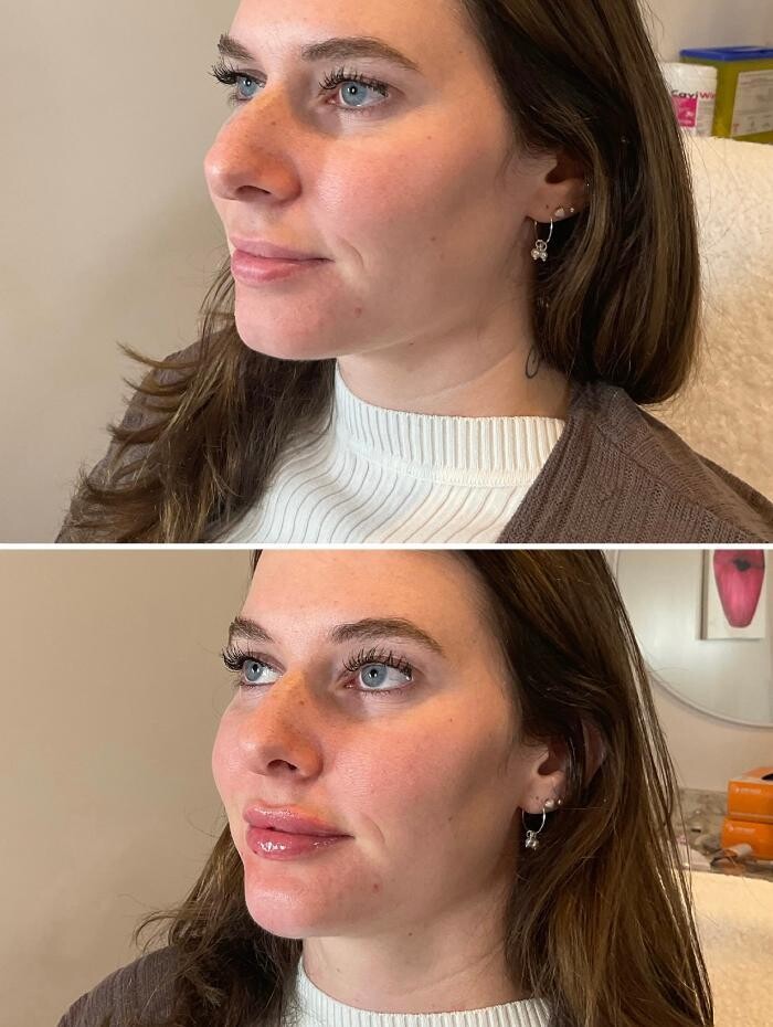 Images Subtle Aesthetics