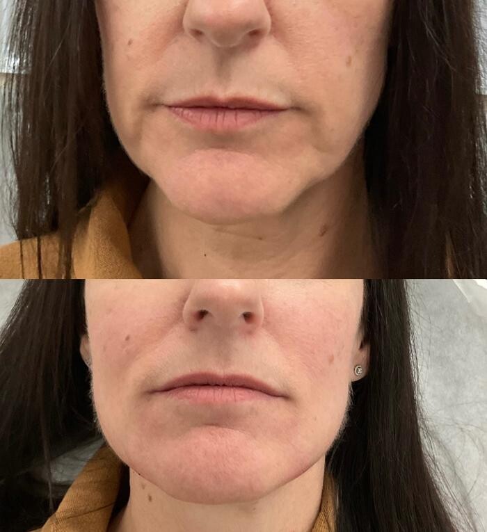 Images Subtle Aesthetics