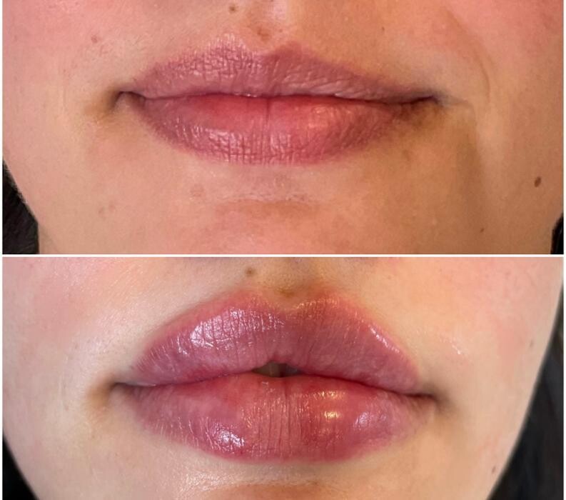 Images Subtle Aesthetics