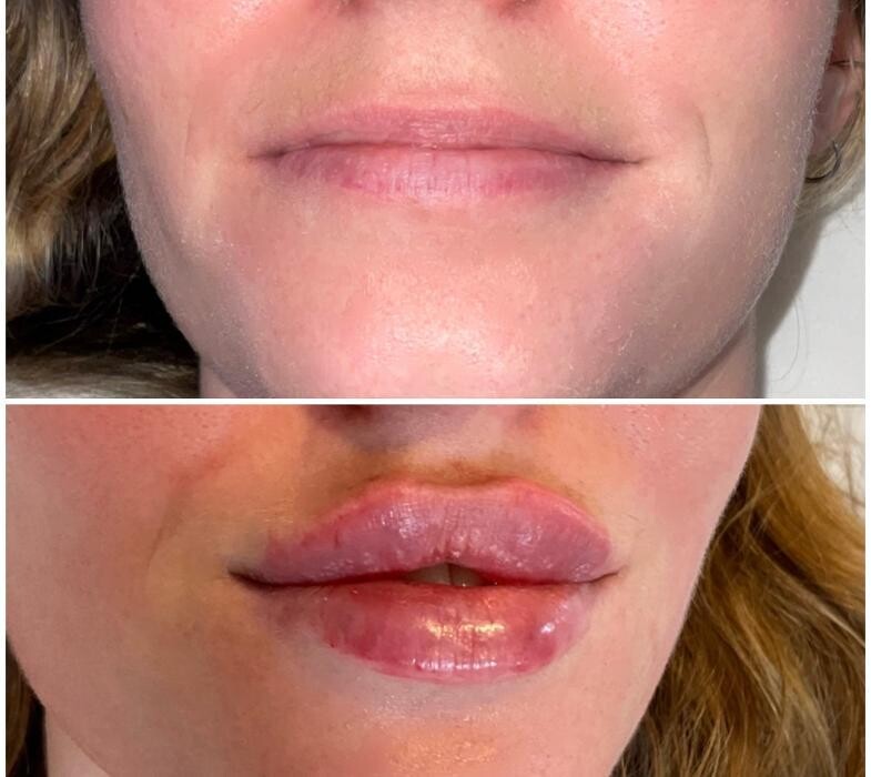 Images Subtle Aesthetics