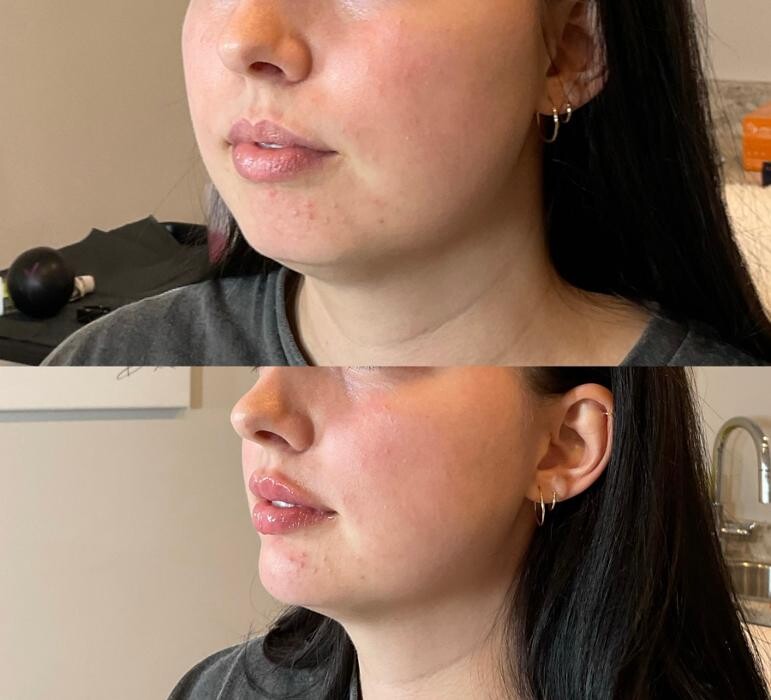 Images Subtle Aesthetics