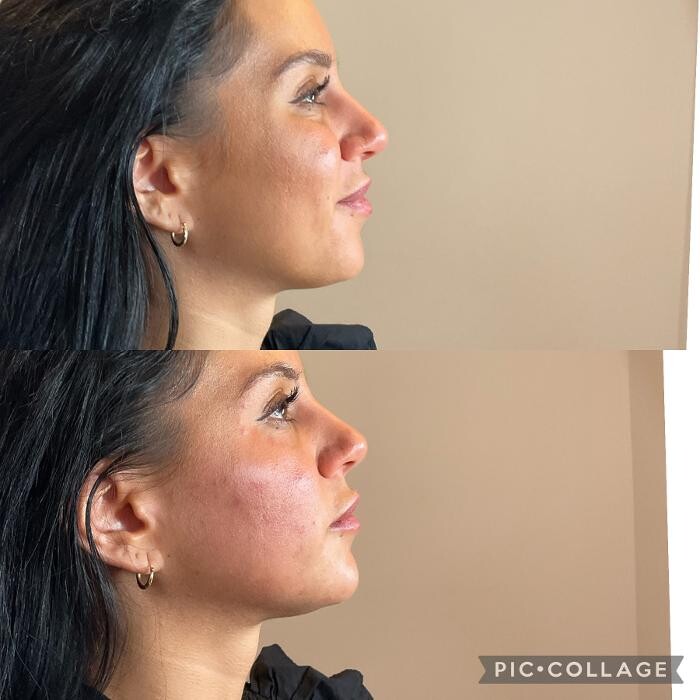 Images Subtle Aesthetics