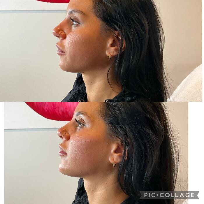 Images Subtle Aesthetics