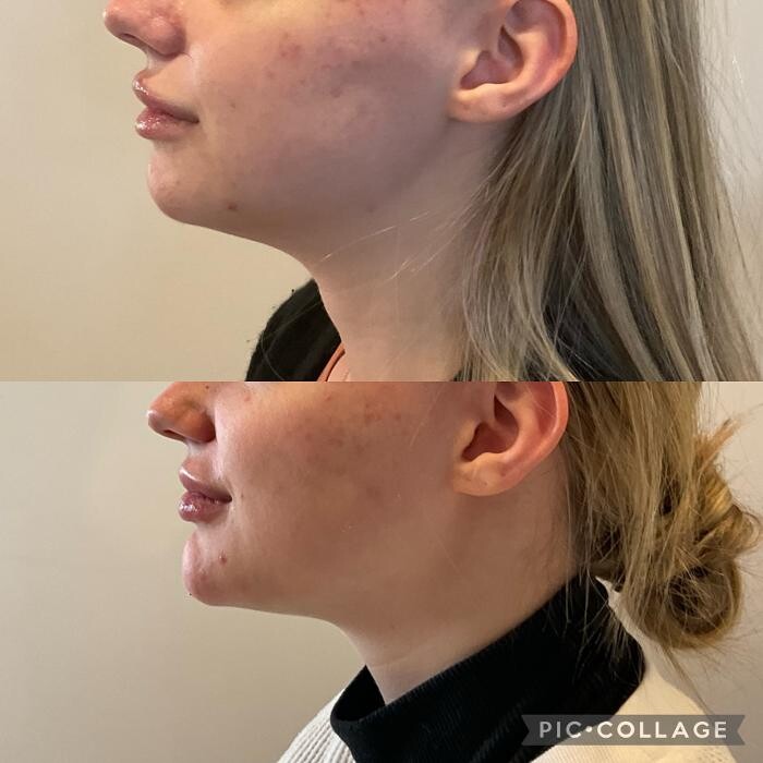 Images Subtle Aesthetics