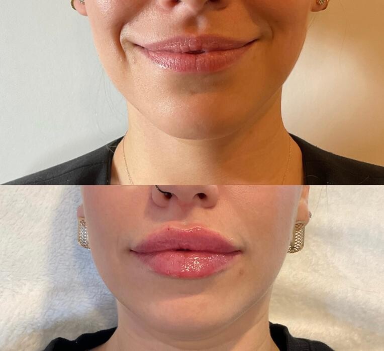 Images Subtle Aesthetics