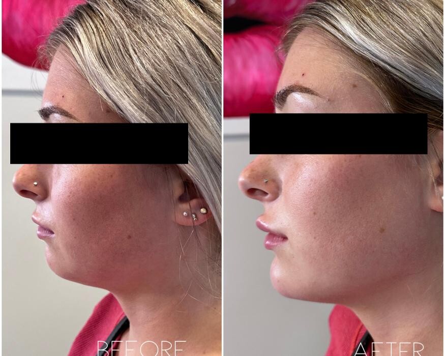 Images Subtle Aesthetics