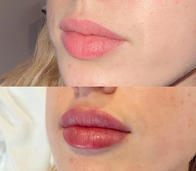 Images Subtle Aesthetics