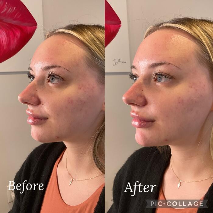 Images Subtle Aesthetics