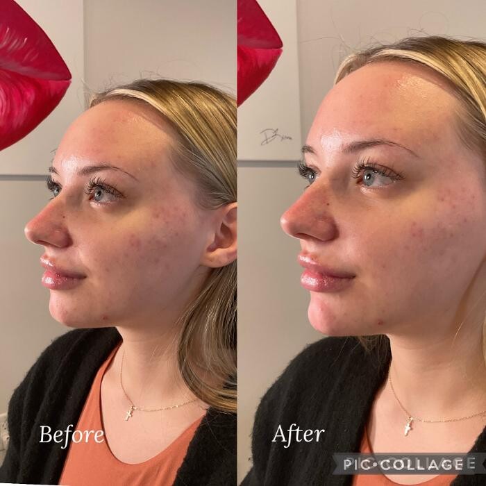 Images Subtle Aesthetics