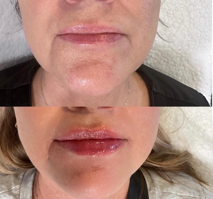 Images Subtle Aesthetics