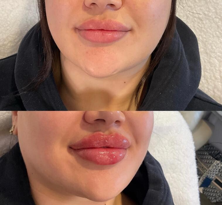 Images Subtle Aesthetics