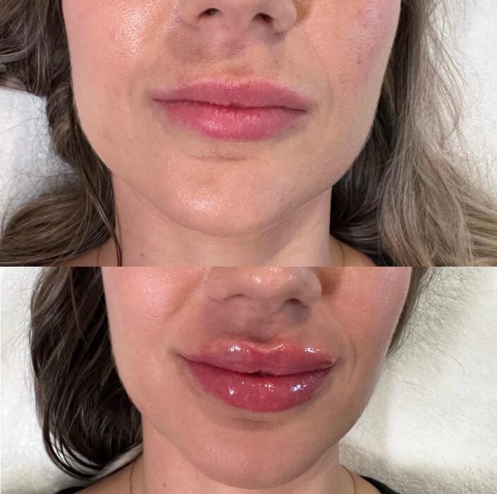 Images Subtle Aesthetics