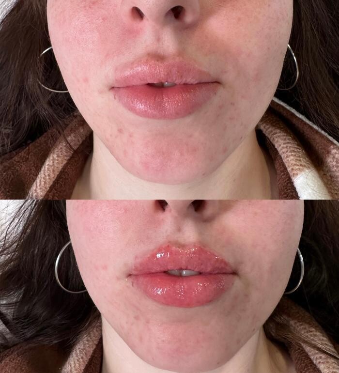 Images Subtle Aesthetics