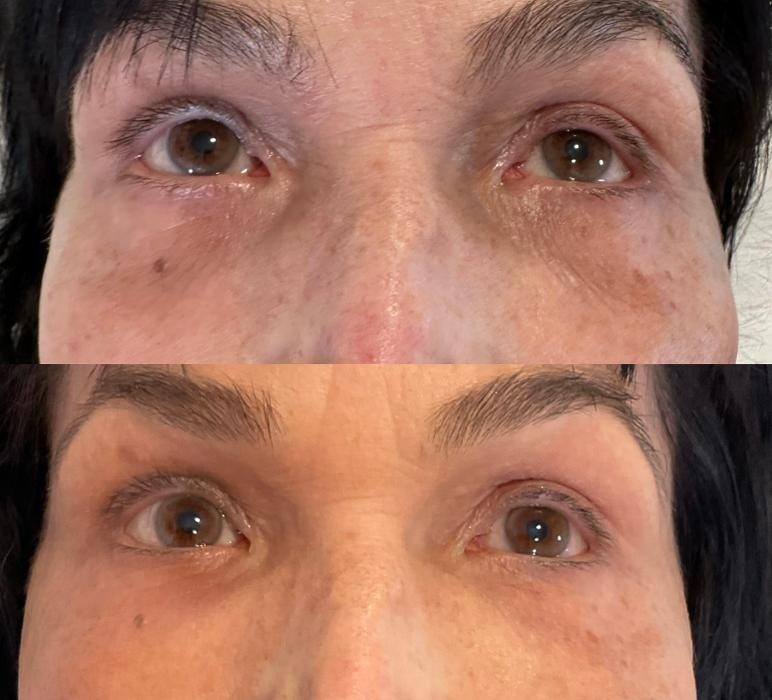 Images Subtle Aesthetics