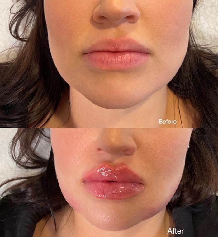 Images Subtle Aesthetics