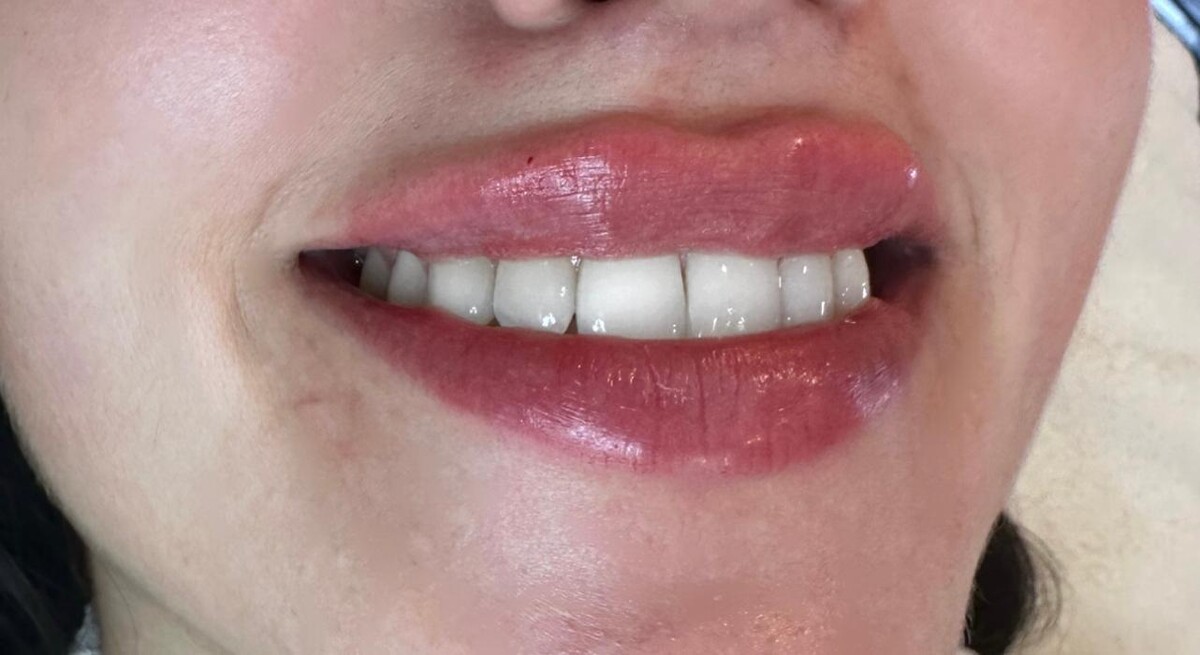 Images Subtle Aesthetics