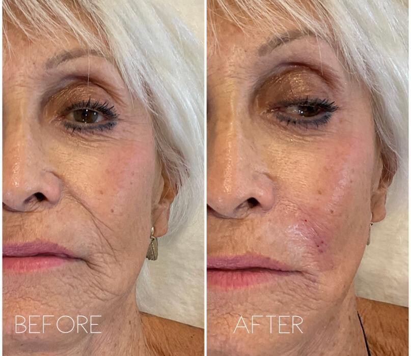 Images Subtle Aesthetics