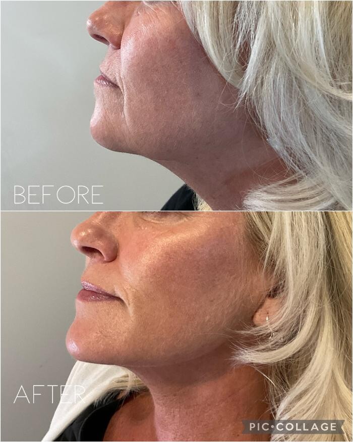 Images Subtle Aesthetics