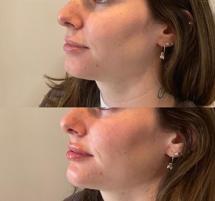 Images Subtle Aesthetics