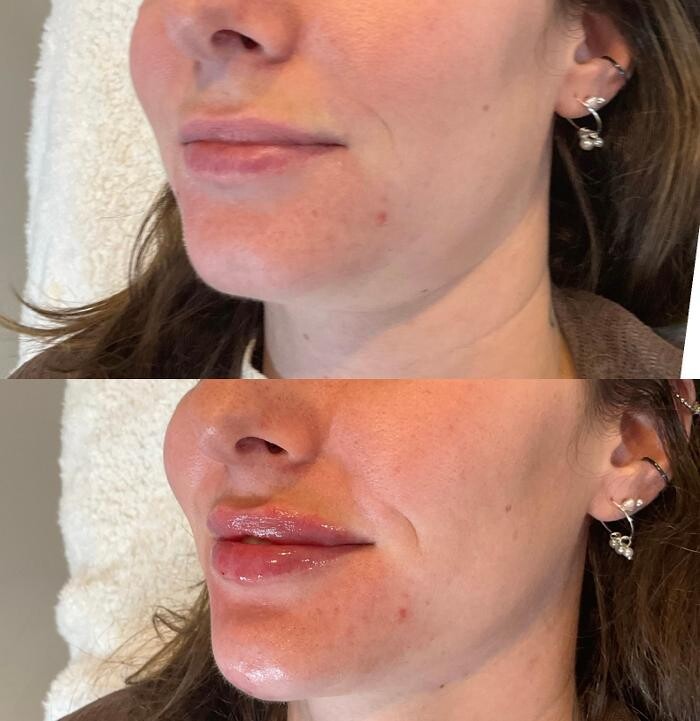 Images Subtle Aesthetics