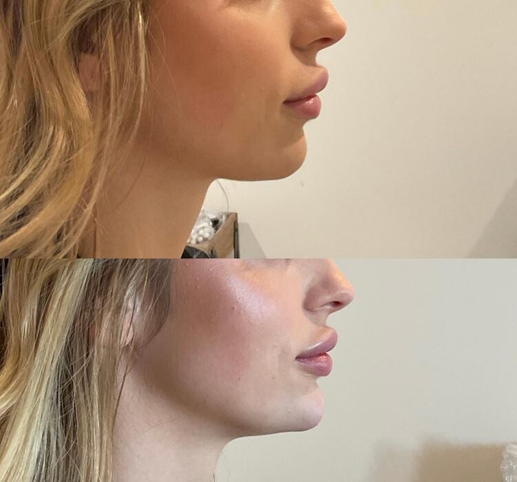 Images Subtle Aesthetics