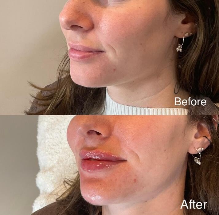 Images Subtle Aesthetics