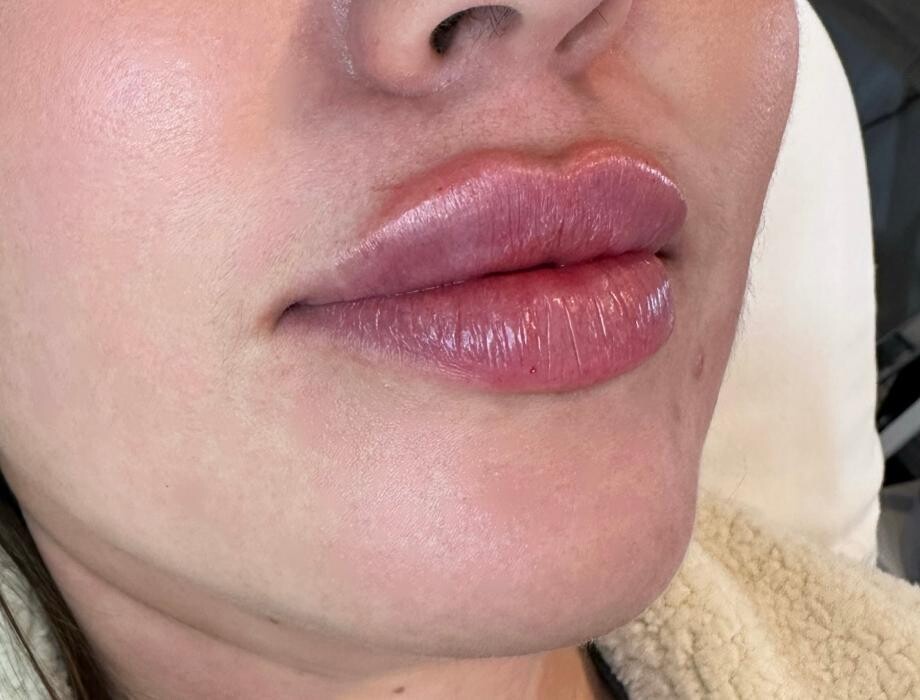 Images Subtle Aesthetics