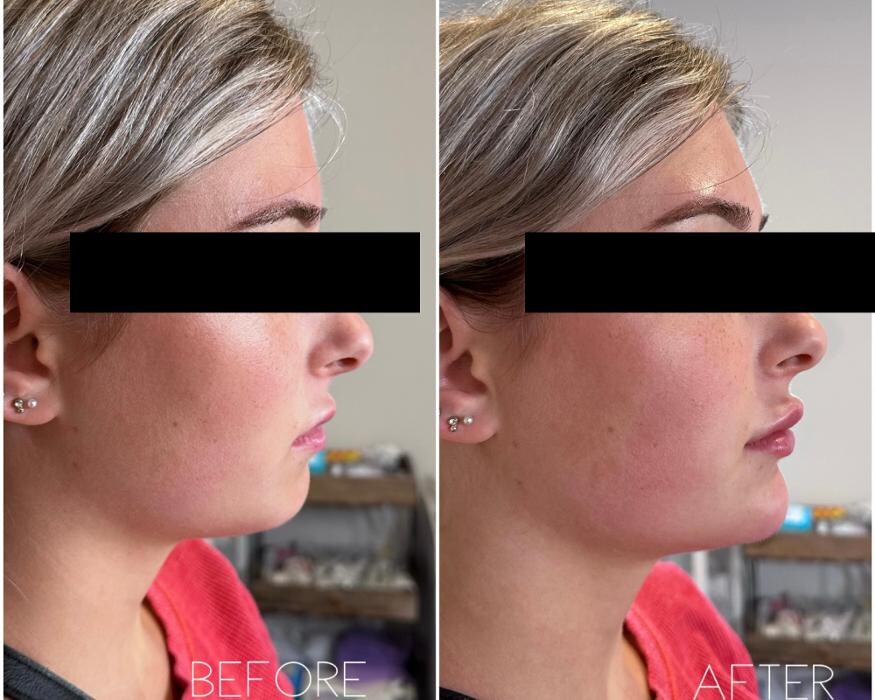 Images Subtle Aesthetics