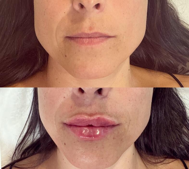 Images Subtle Aesthetics