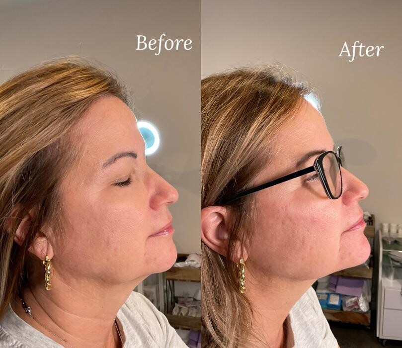 Images Subtle Aesthetics