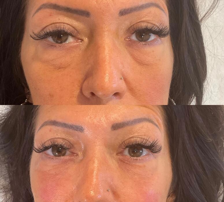 Images Subtle Aesthetics